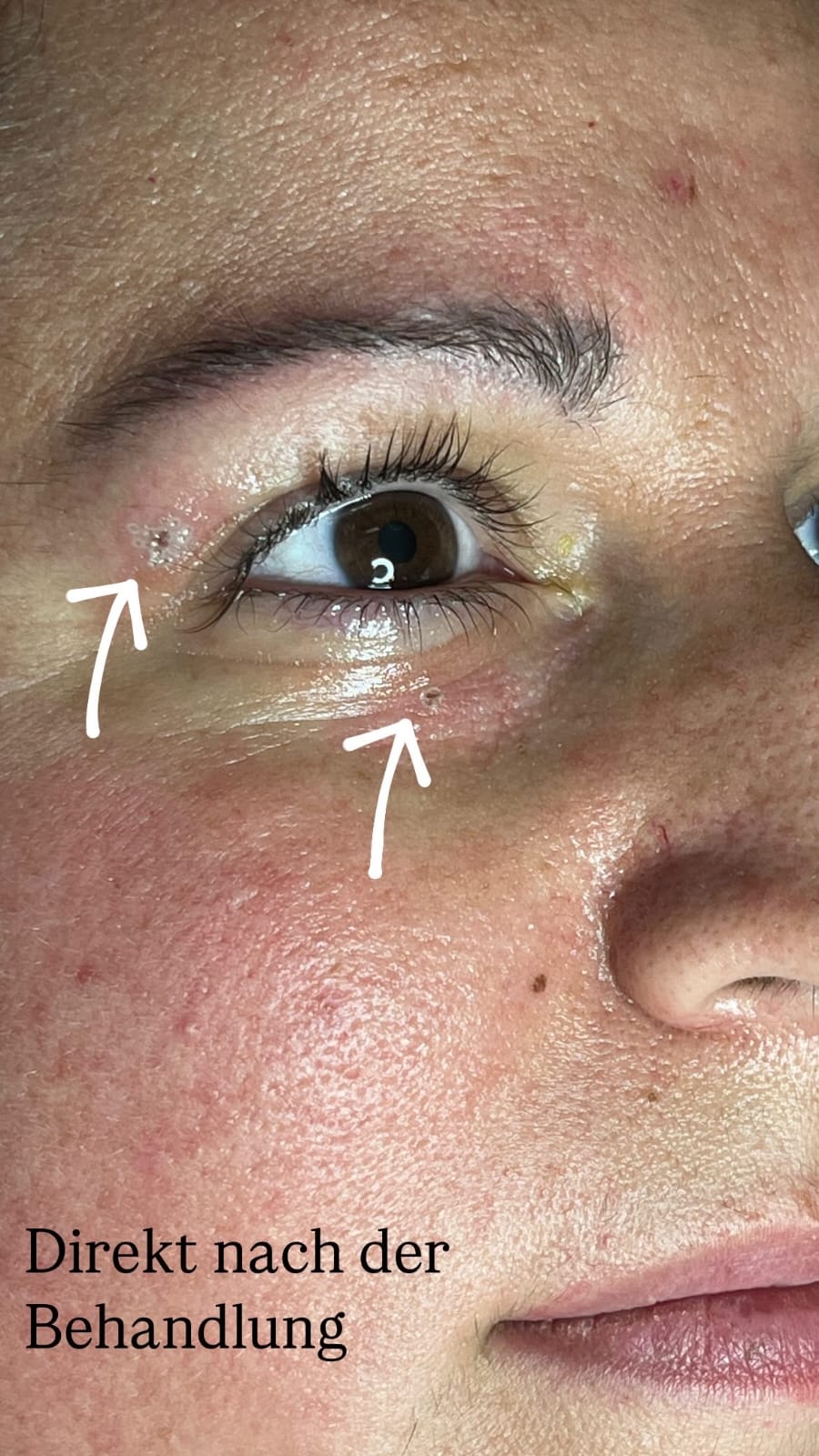 Behandlungsergebnis