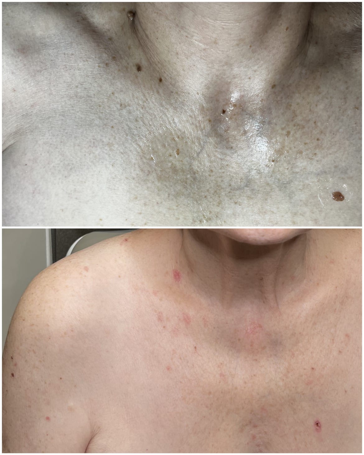 Behandlungsergebnis