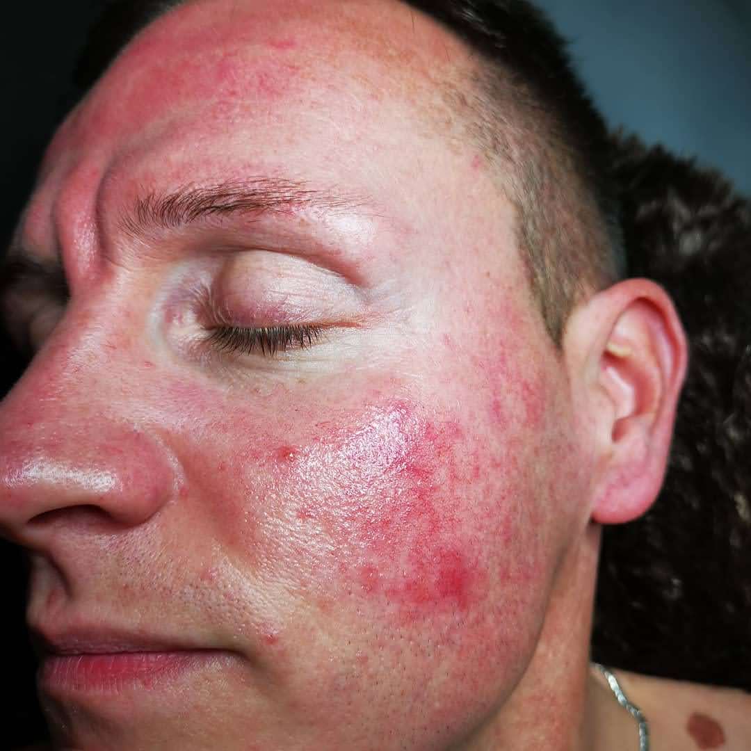 Behandlungsergebnis