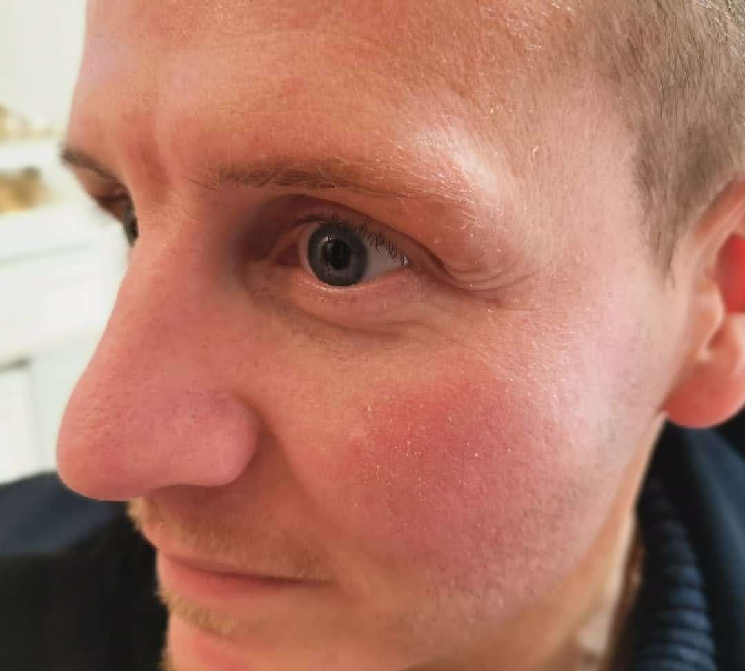Behandlungsergebnis