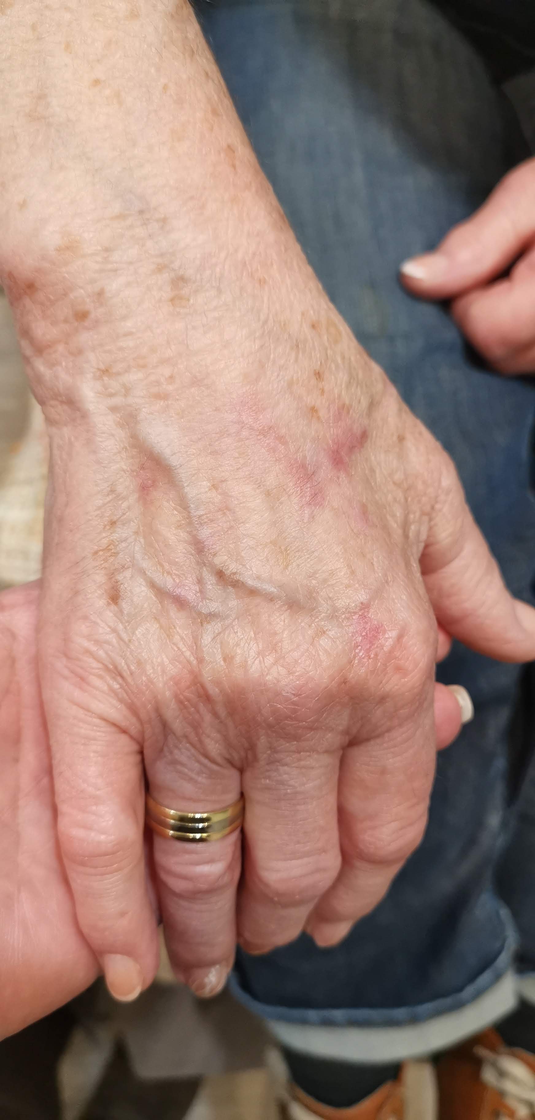 Behandlungsergebnis